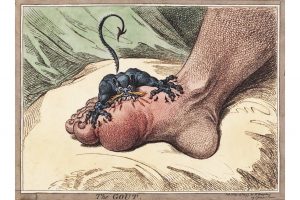 Подагра и ее лечение (в том числе грибами)