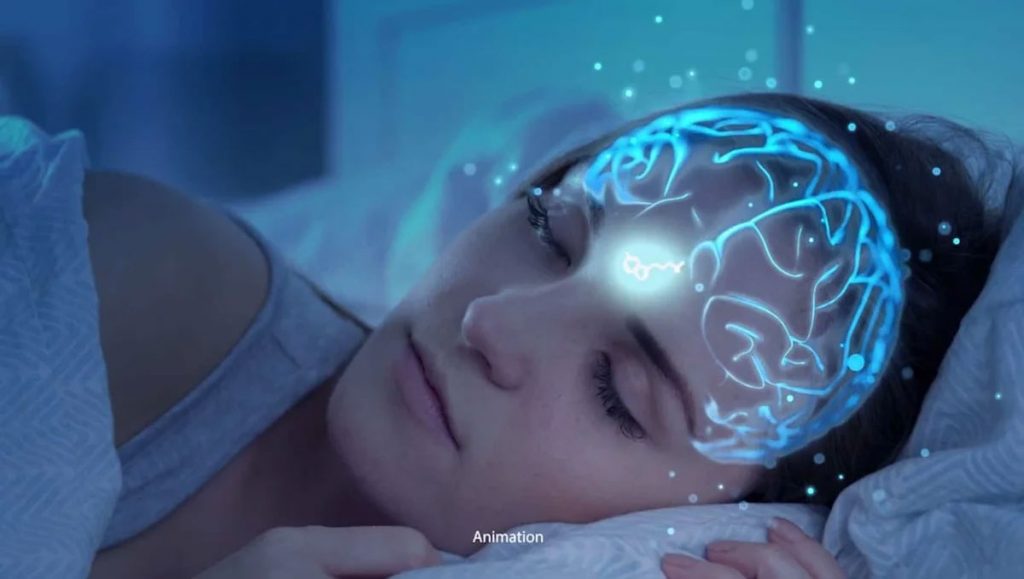 Расстройства сна